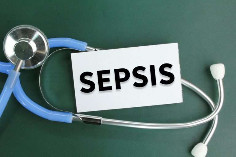 stethoscope and white paper with the word SEPSIS.